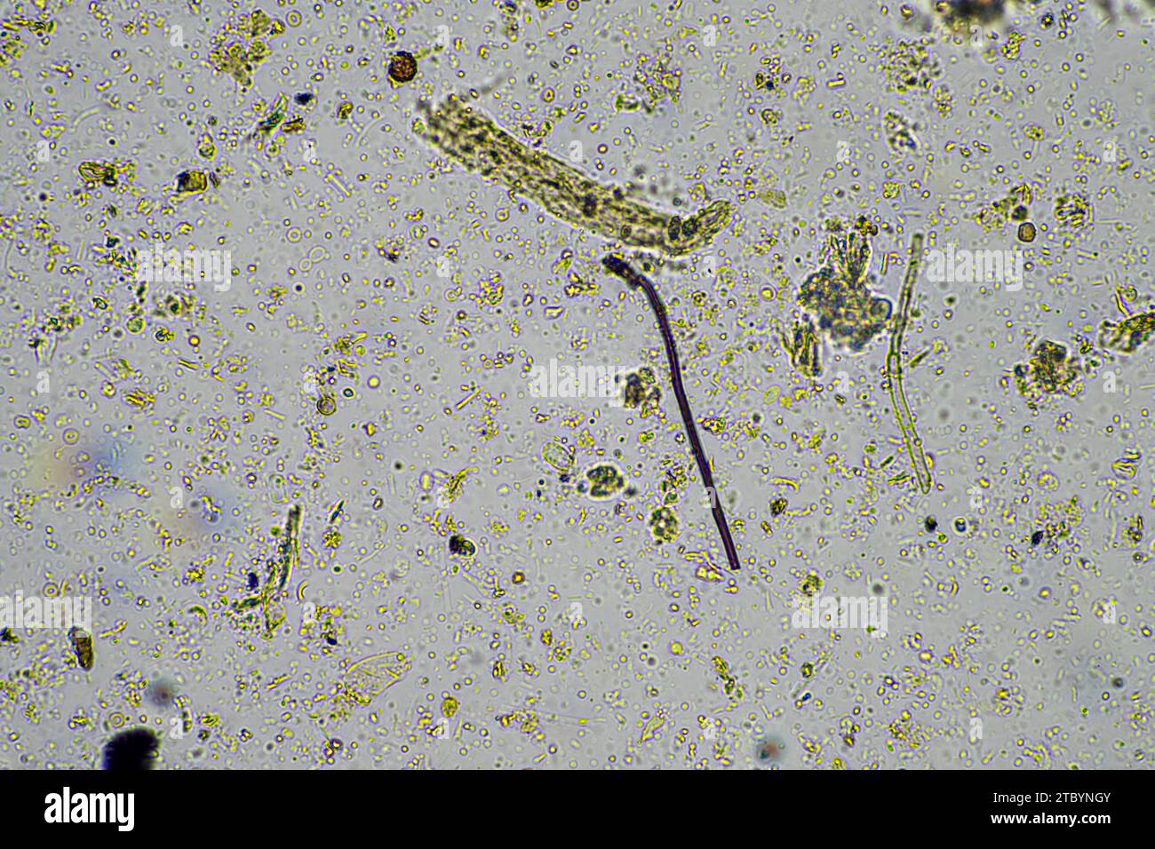 soil microbes under the microscope. microorganisms with fungus in compost Stock Photo