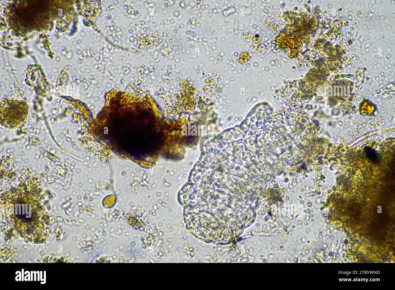 microorganisms and a tardigrade in a soil sample on a farm Stock Photo