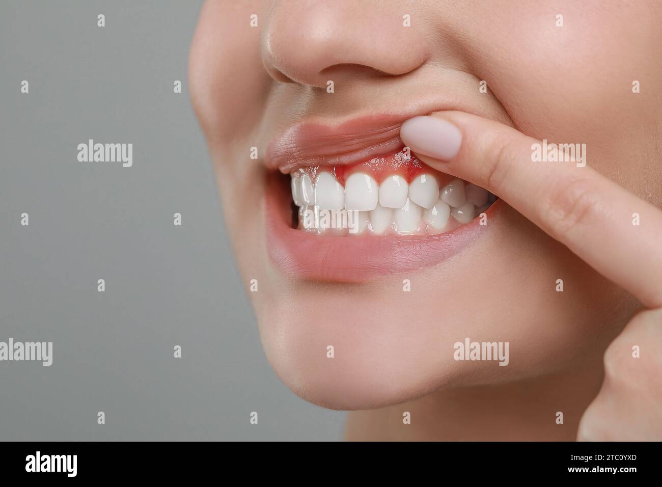 Woman showing inflamed gum on grey background, closeup. Space for text Stock Photo