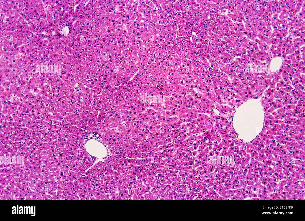 Human healthy liver with normal hepatocytes. Optical microscope. Magnification X100. Stock Photo