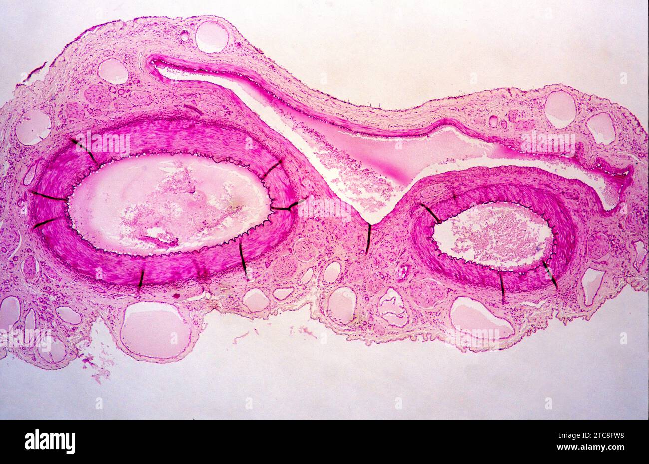 Venules, cross section.Optical microscope, magnification X40. Stock Photo