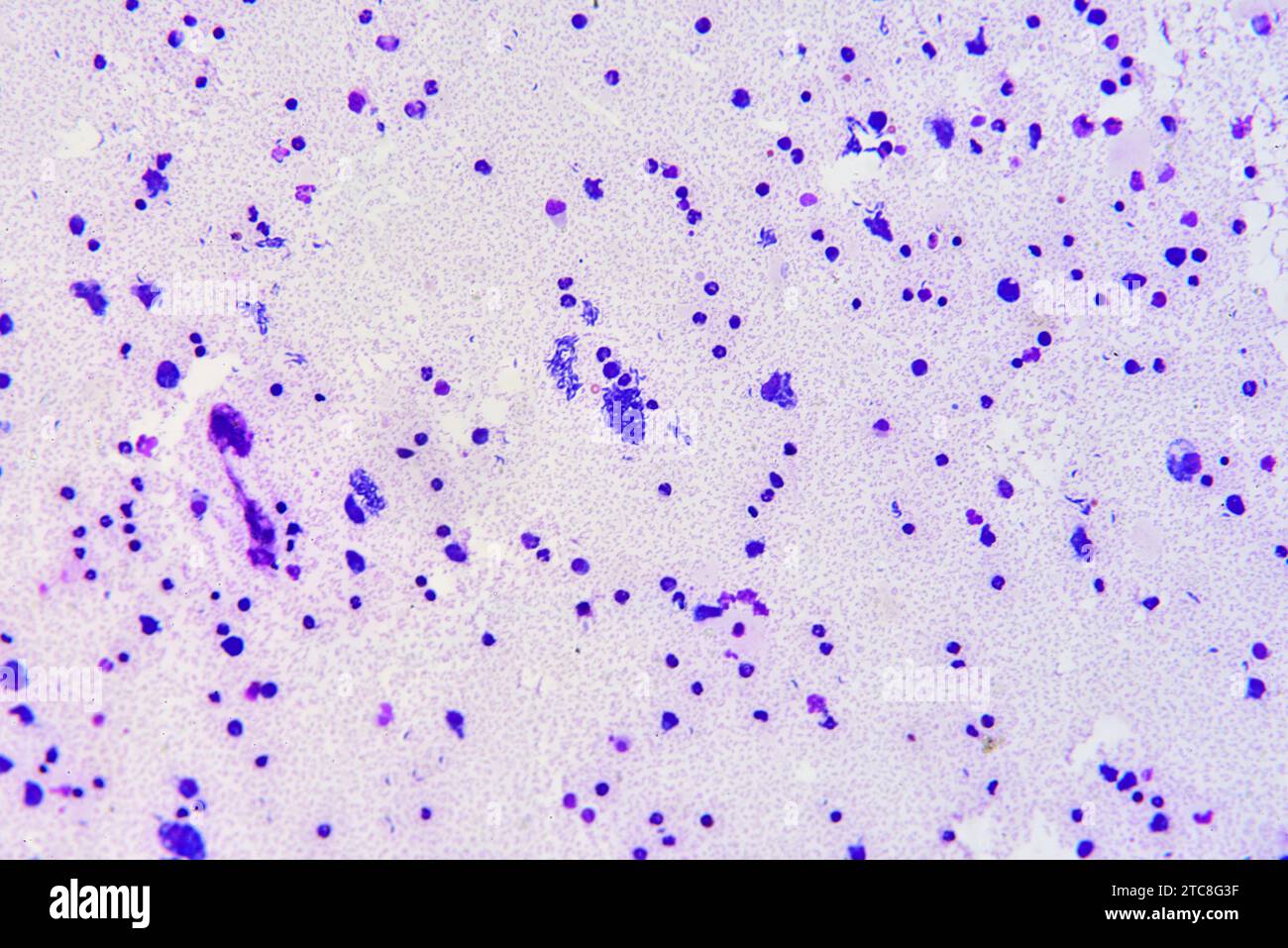 Toxoplasma gondii parasitic alveolata toxoplasmosis responsible. Optical microscope X200. Stock Photo