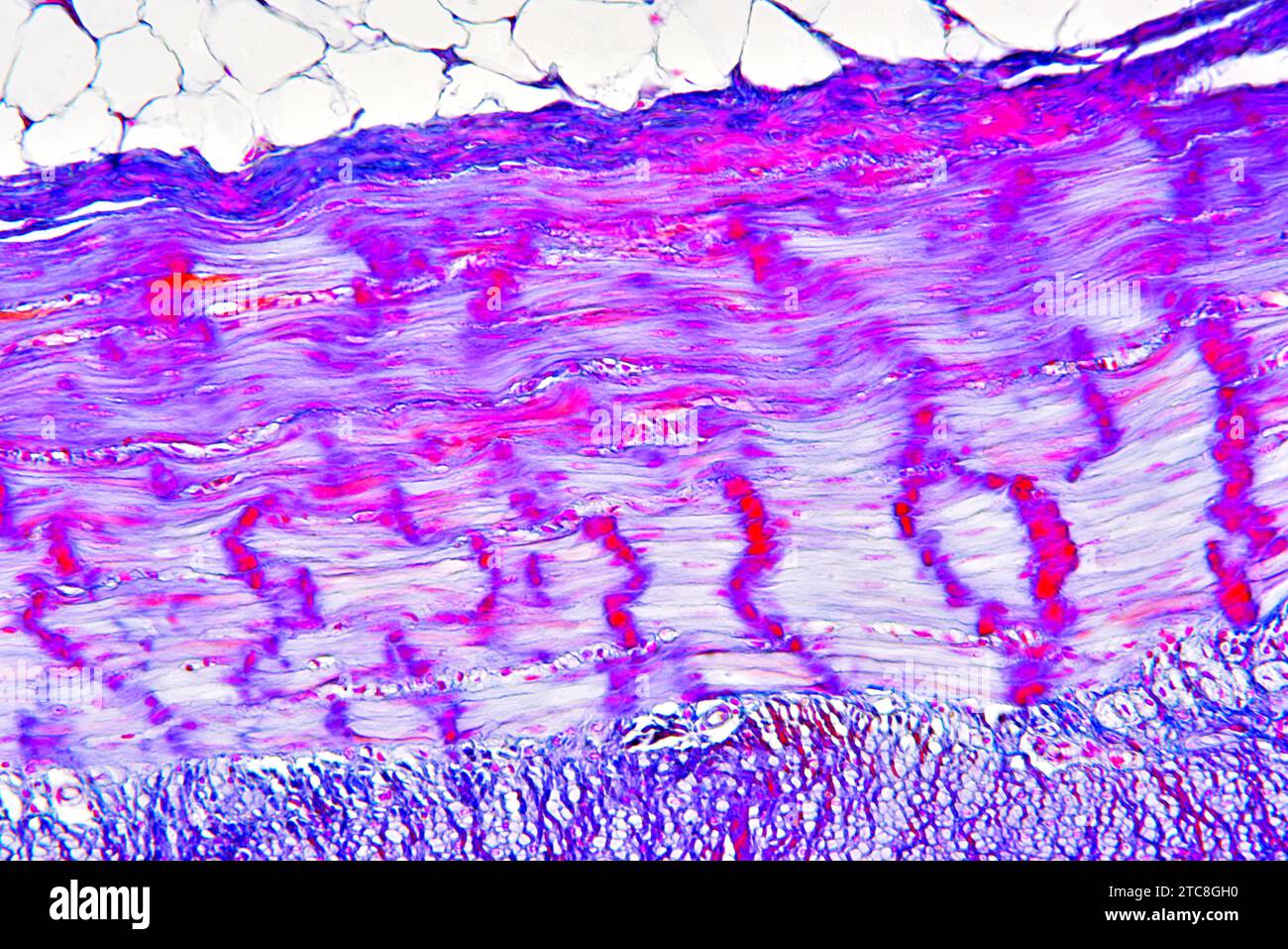 Smooth muscle, adipose and connective tissues of colon. Light microscope X300 at 10 cm wide. Stock Photo