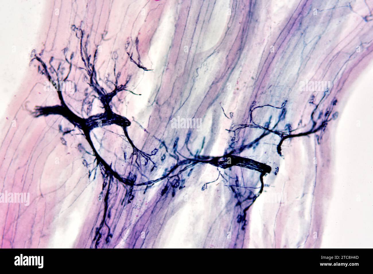 Ending motor neurona. Light microscope X150 at 10 cm wide Stock Photo ...