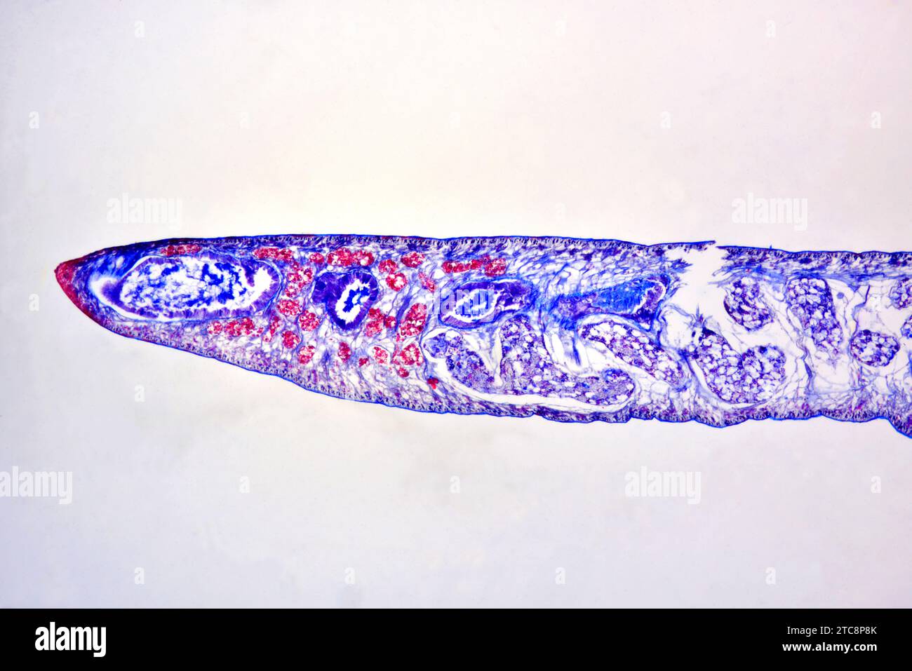 Lancet liver fluke (Dicrocoelium dendriticum or Dicrocoelium