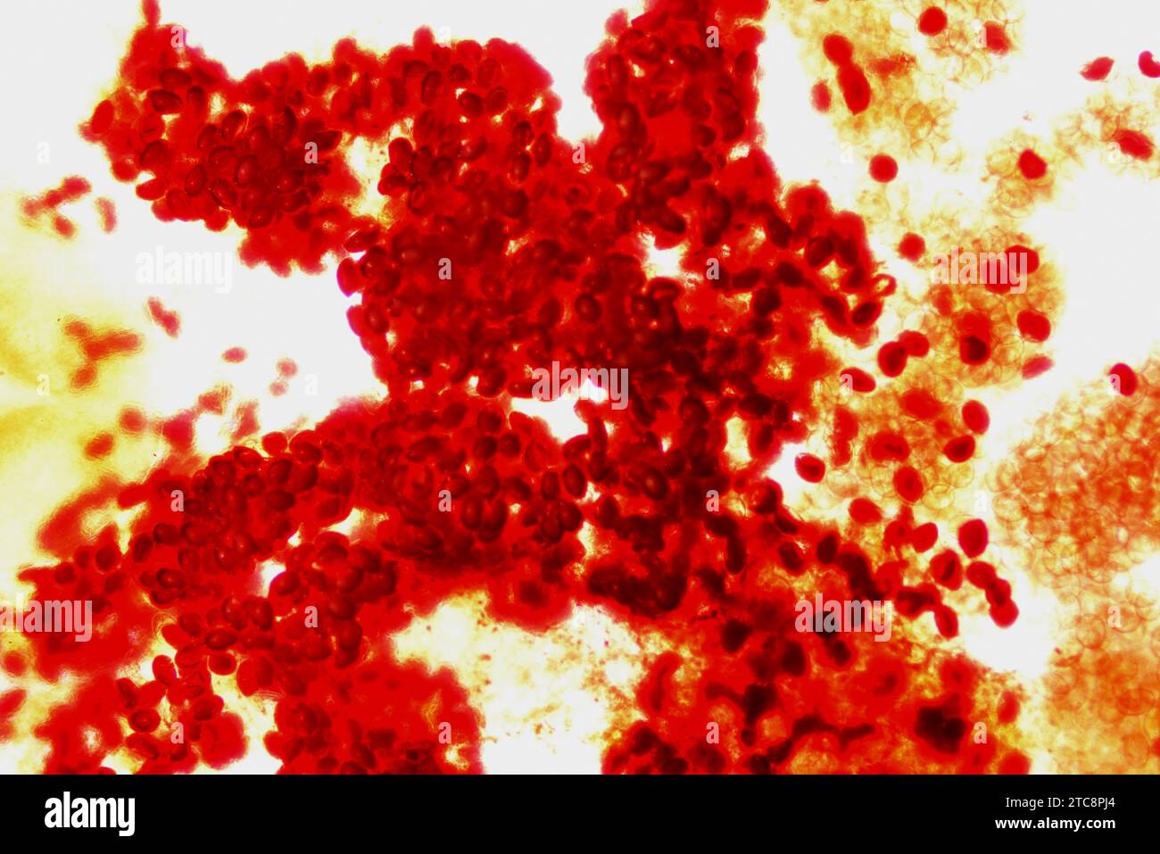 Common liver fluke (Fasciola hepatica or Distomum hepaticum) eggs. Light microscope X50 at 10 cm wide. Stock Photo