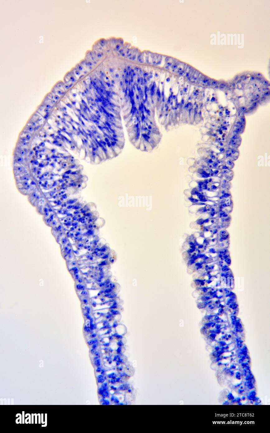 Hydra, light micrograph Stock Photo - Alamy, image size:867x1390