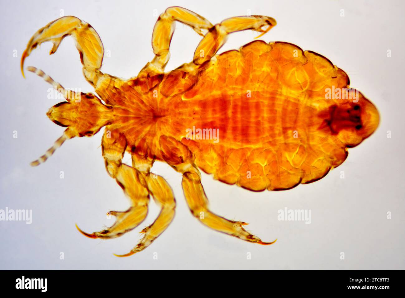 Head louse (Pediculus humanus capitis) complet specimen. Light microscope X50 at 10 cm wide. Stock Photo