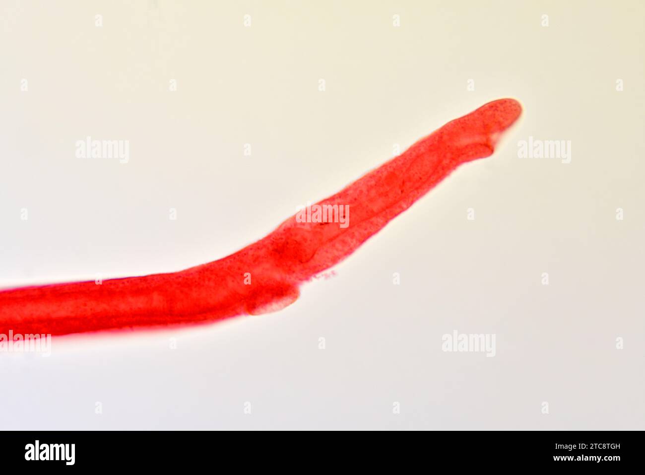 Schistosoma mansoni female oral region. Light microscope X150 at 10 cm wide. Stock Photo