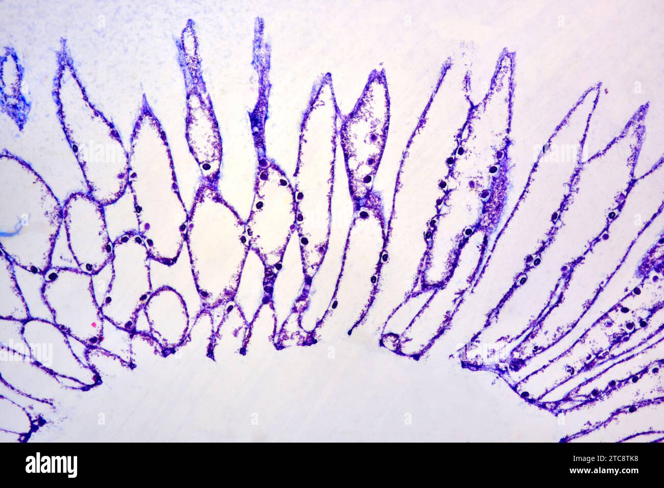 Calcareous sponge (Sycon) cross section showing choanocyte chambers