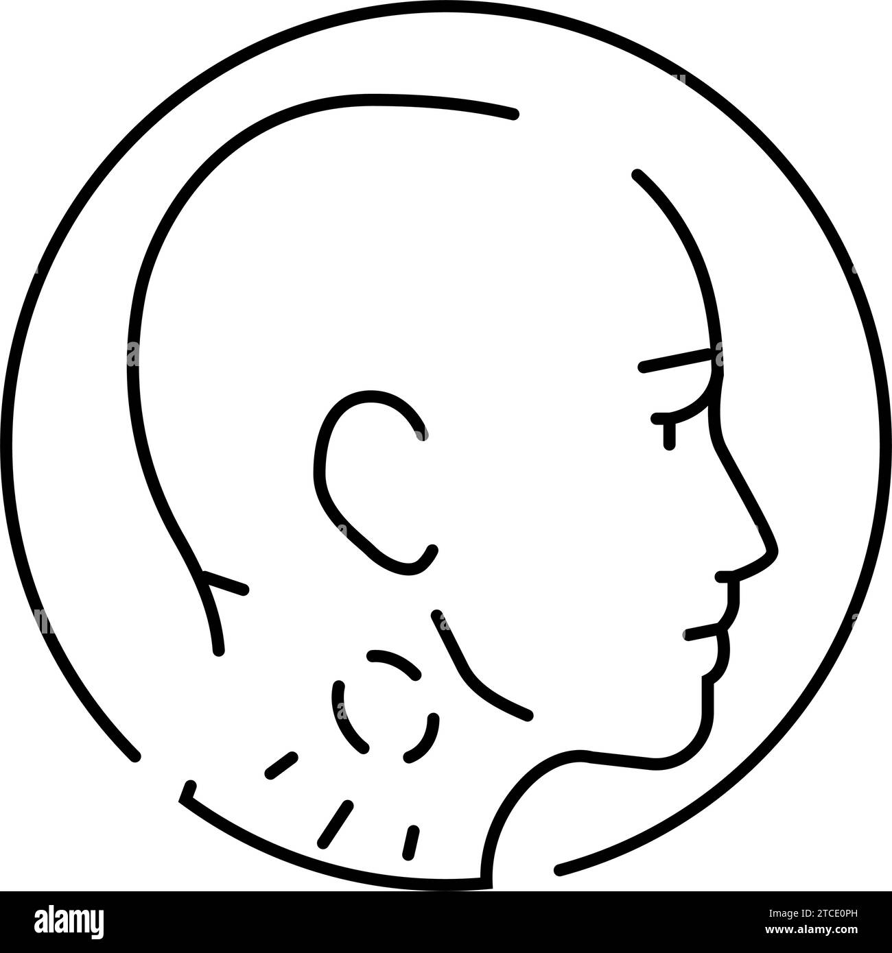 Swollen glands Black and White Stock Photos & Images Alamy