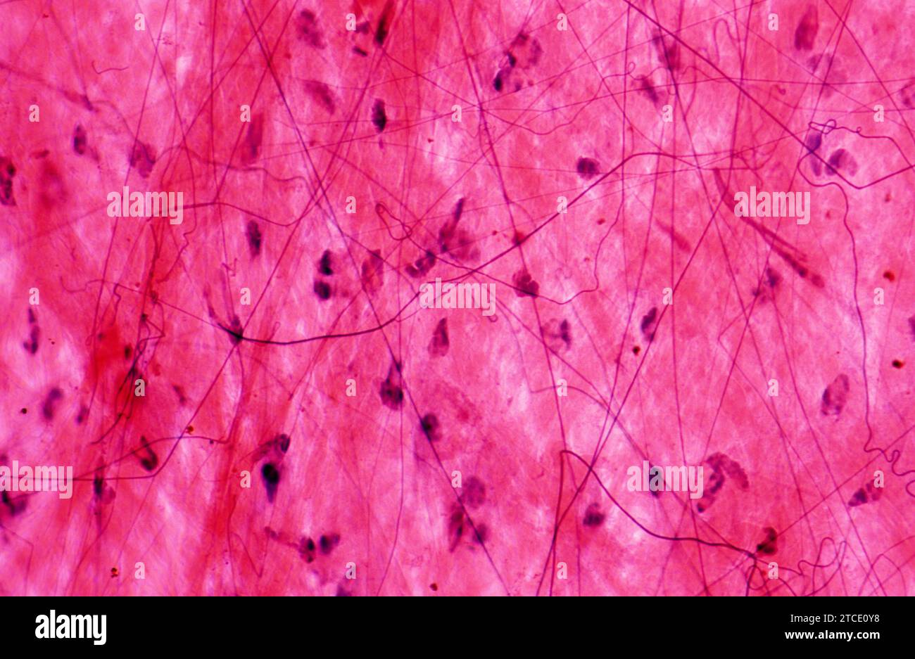 Loose connective tissue seen at light microscope X100. It is constituid