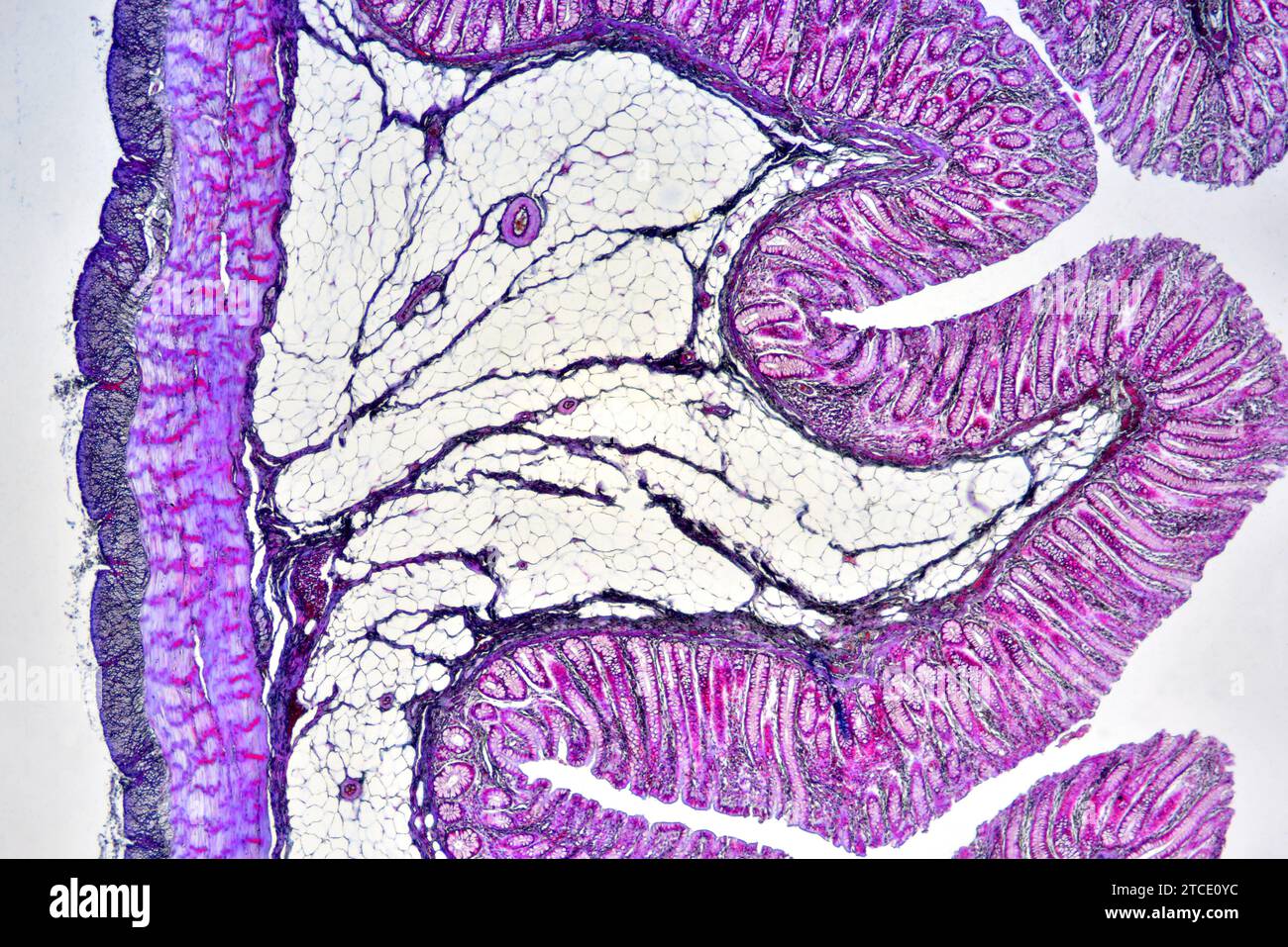 Human colon showing epithelium, mucosa, submucosa, muscular layer, adipose tissue, serosa, intestinal glands, villi and vessels. Optical microscope X4 Stock Photo