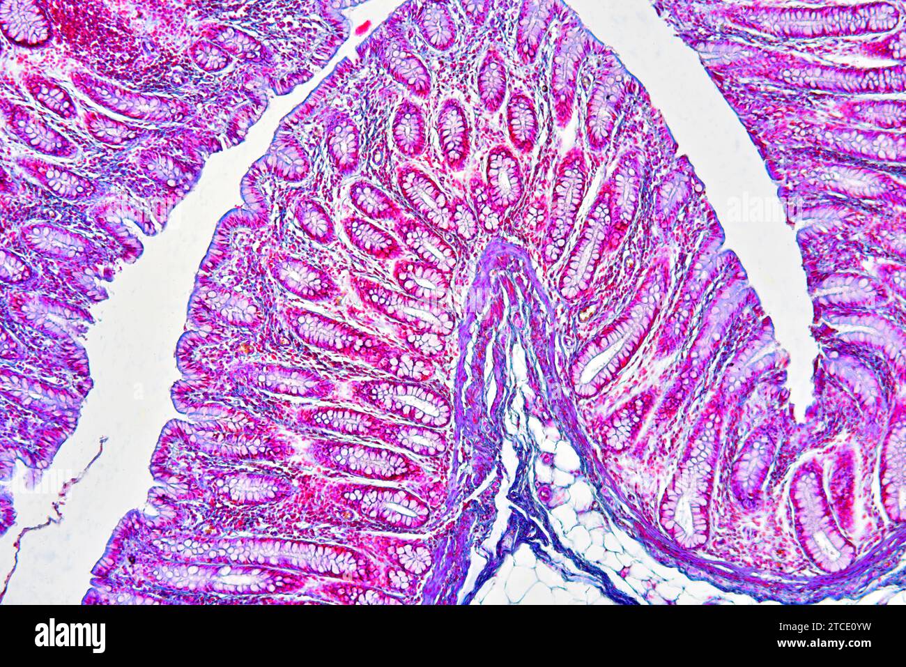 Human colon showing epithelium, mucosa, submucosa, adipose tissue ...