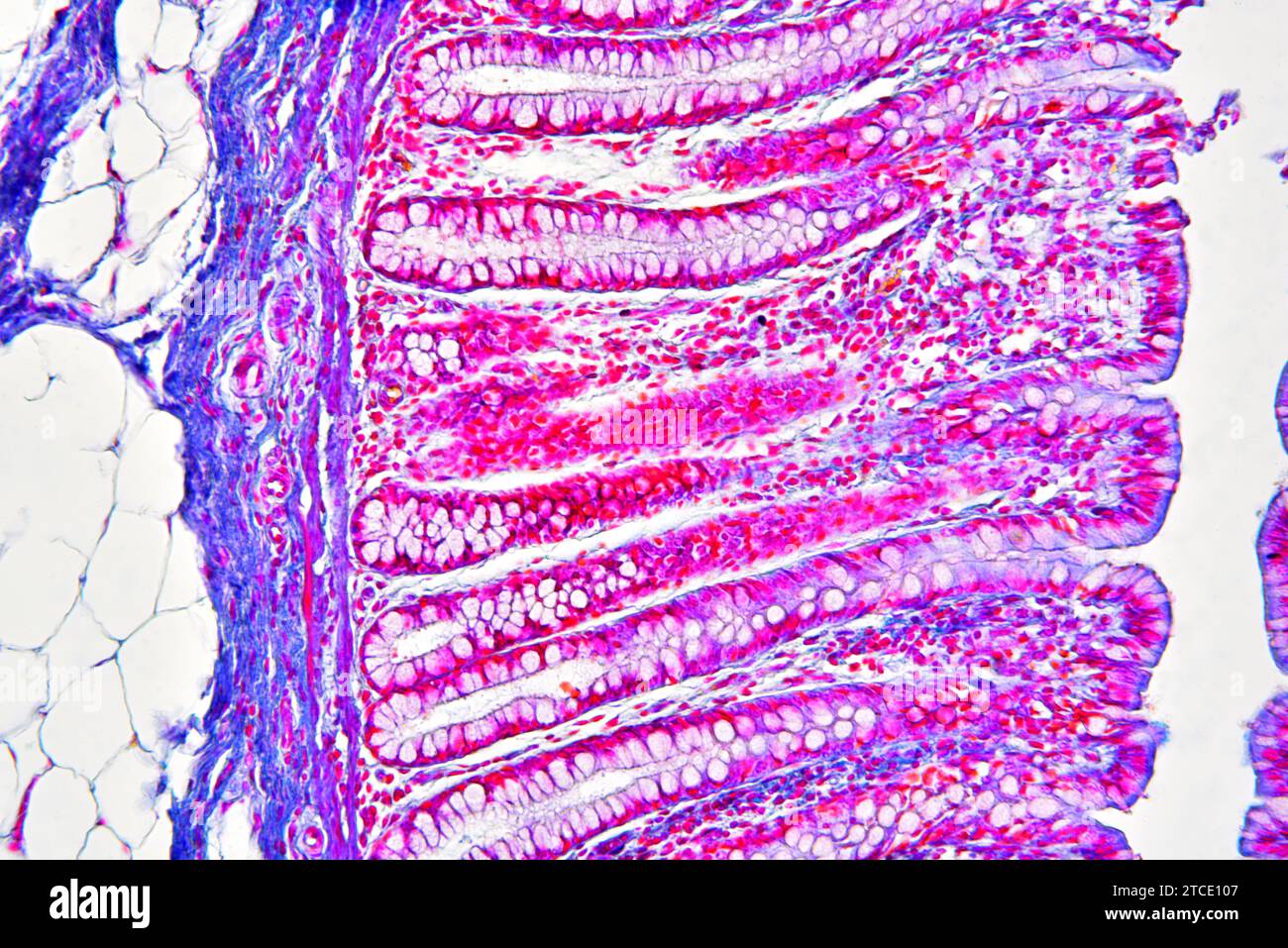 Human colon showing epithelium, mucosa, submucosa, adipose tissue, intestinal glands and villi. Optical microscope X100. Stock Photo