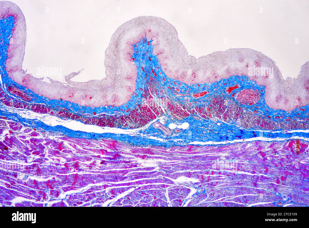 Human esophagus or oesophagus showing squamous epithelium stratified. Optical microscope X40. Stock Photo
