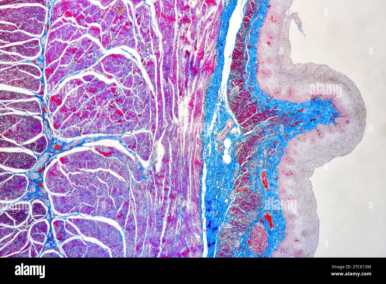 Human esophagus or oesophagus showing squamous epithelium stratified, vessels and muscular layers. Optical microscope X40. Stock Photo