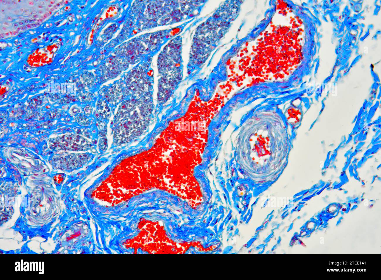 Human esophagus or oesophagus showing vessels, blood and connective tissue. Optical microscope X200. Stock Photo