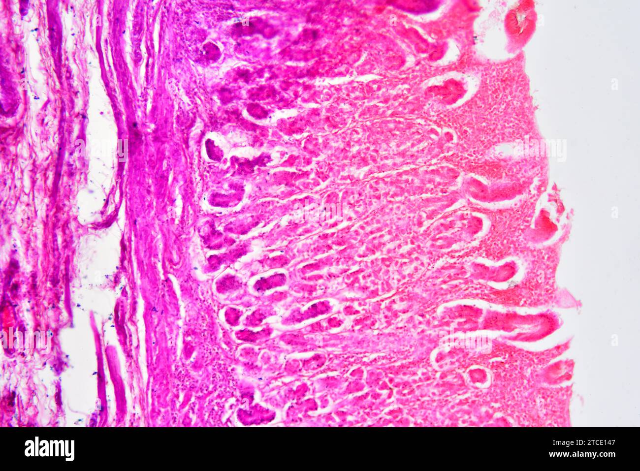 Stomach cross section showing mucosa, submucosa, muscular layer and gastric glands. Optical microscope X100. Stock Photo