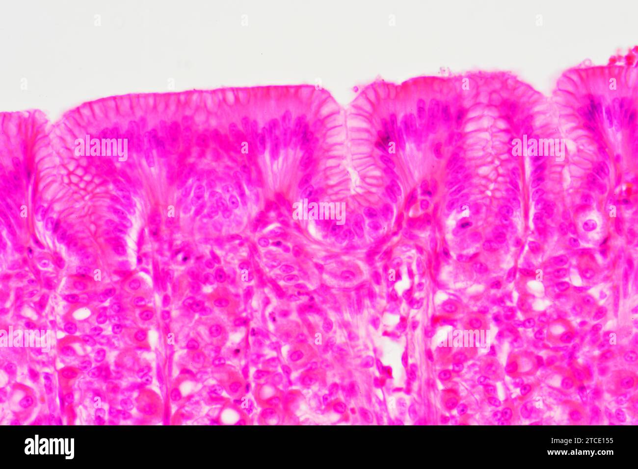 Stomach cross section showing mucosa, submucosa and gastric glands. Optical microscope X400. Stock Photo