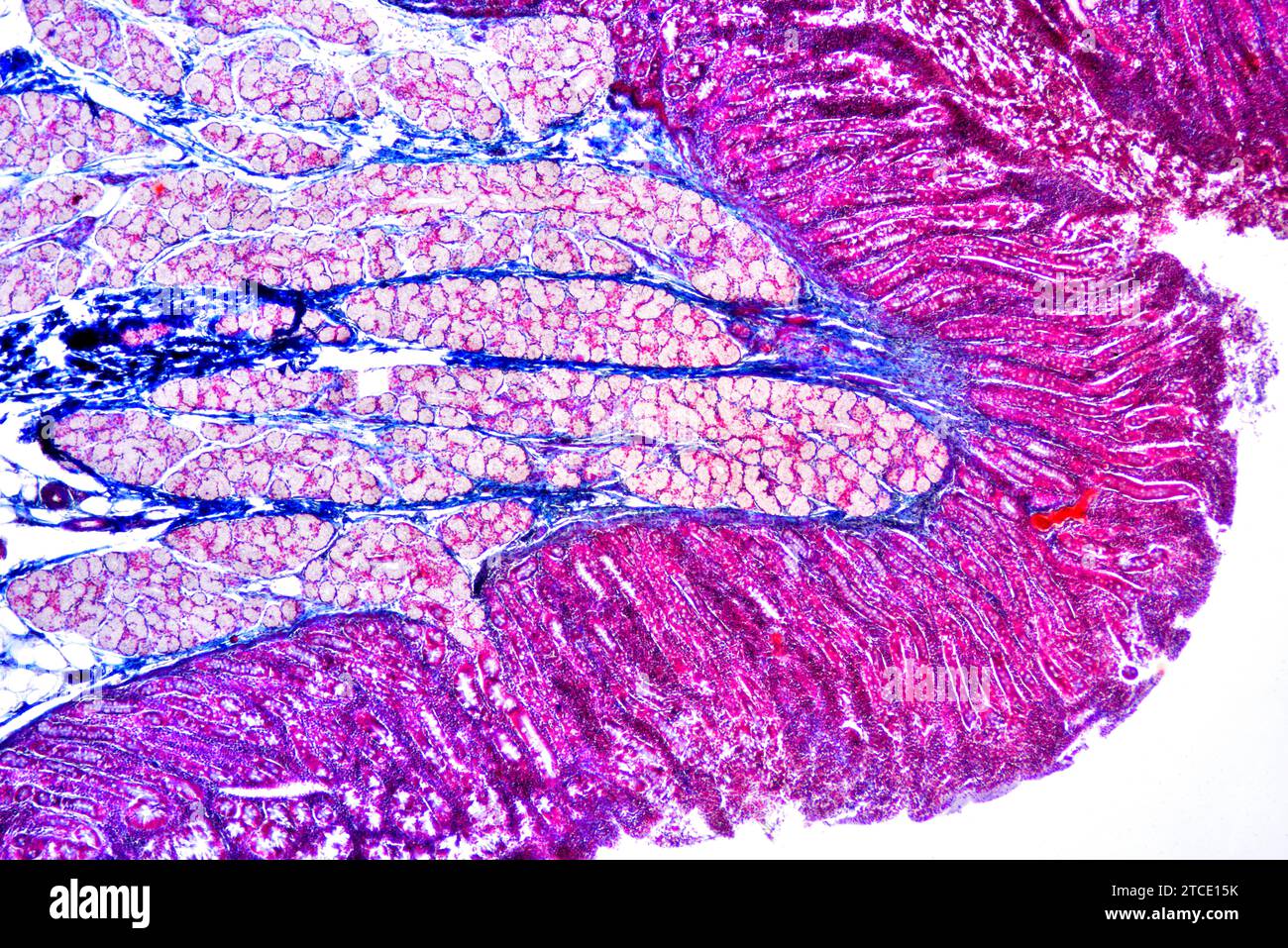 Human duodenum (small intestine) showing villous mucosa, submucosa