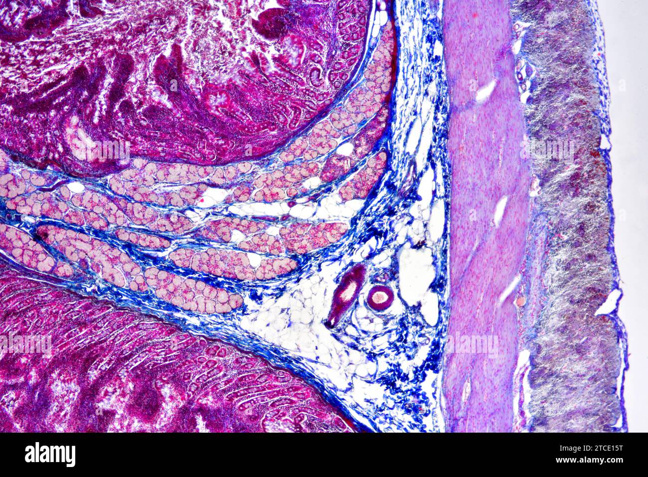 Human duodenum (small intestine) showing villous mucosa, submucosa