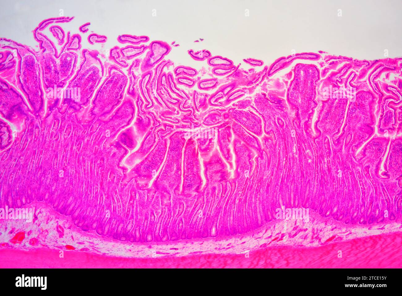 Small intestine cross section hires stock photography and images Alamy