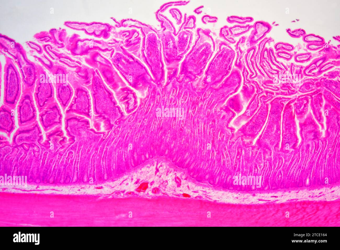 Small intestine cross section showing mucosa, submucosa, lamina propria