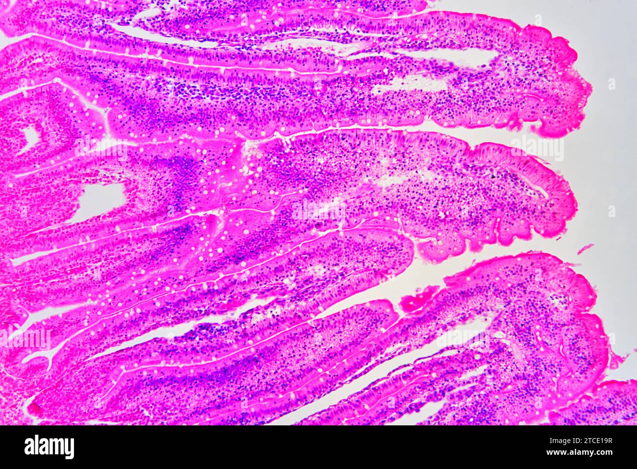Small intestine cross section showing mucosa, submucosa and Brunner
