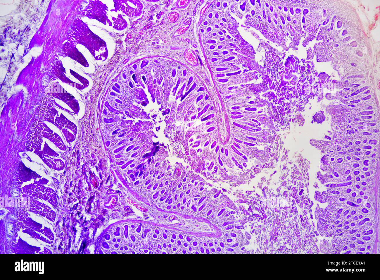 Small intestine cross section showing mucosa, submucosa, lamina propria