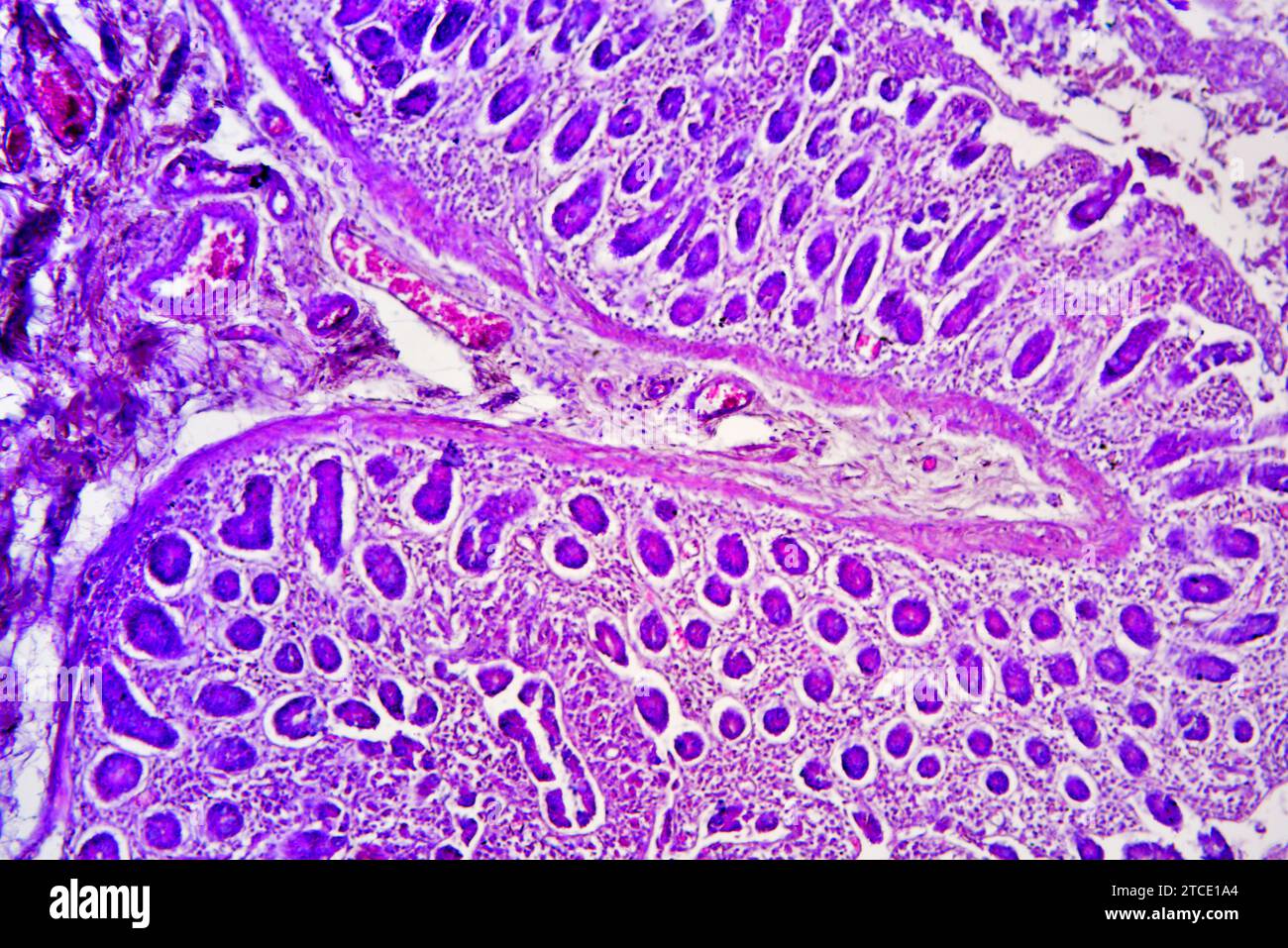 Small intestine cross section showing mucosa, submucosa, lamina propria