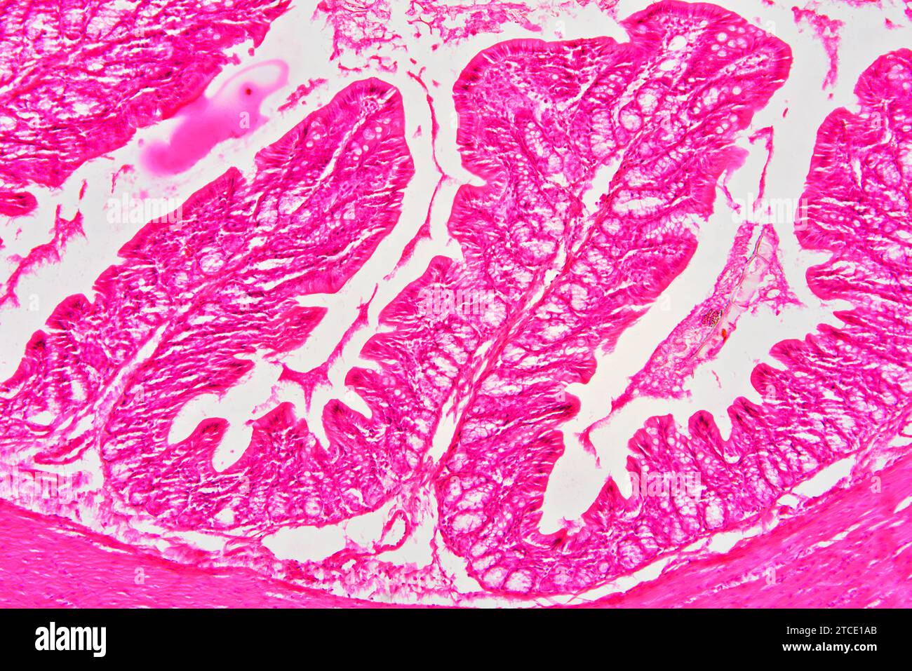 Rectum (large intestine) showing muscular layer, lamina propria, submucosa, mucosa,  epithelium, villi and intestinal glands. Optical microscope X100. Stock Photo