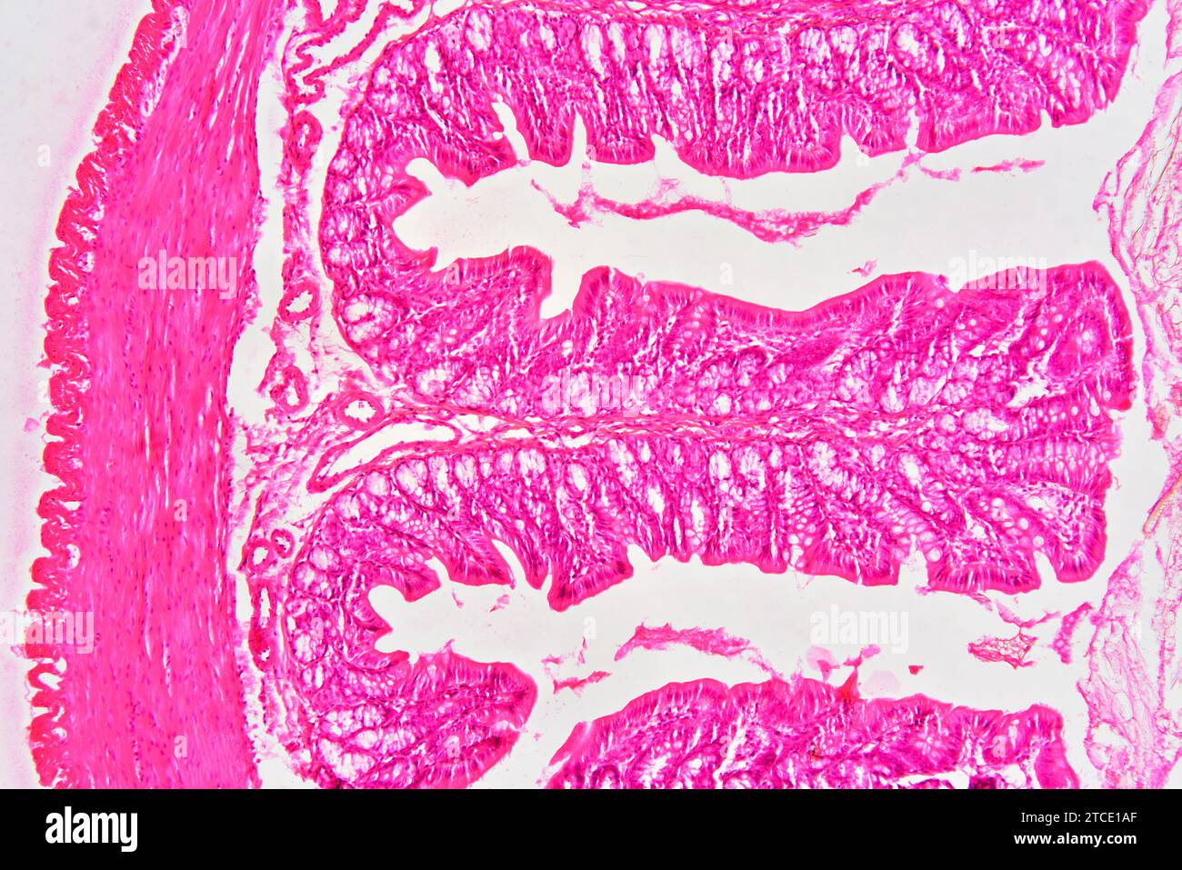 Rectum (large intestine) showing adventitia, muscular layer, lamina propria, submucosa, mucosa, epithelium, villi and intestinal glands. Optical micro Stock Photo