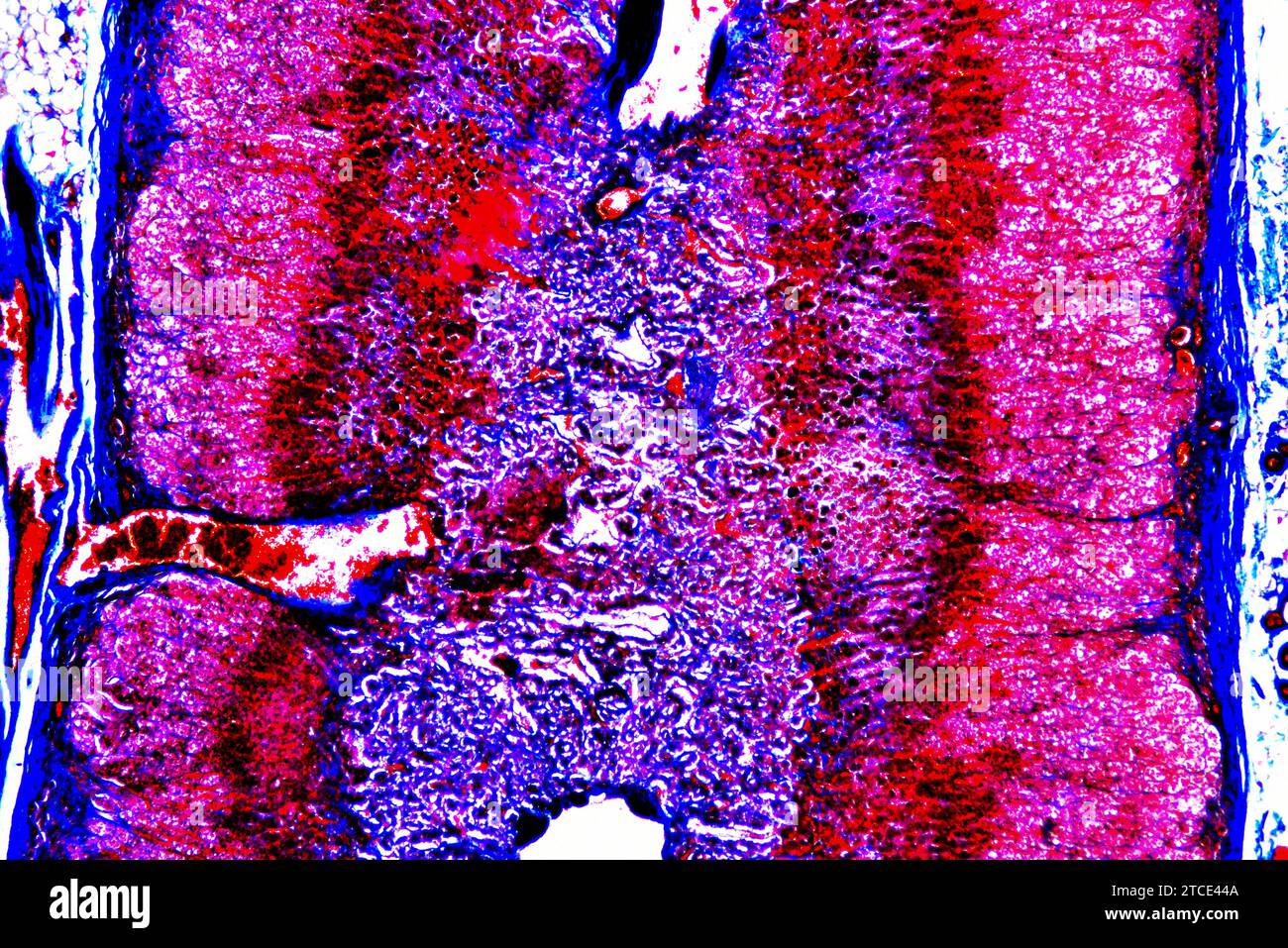 Human adrenal or suprarenal gland showing fibrous capsule, zona