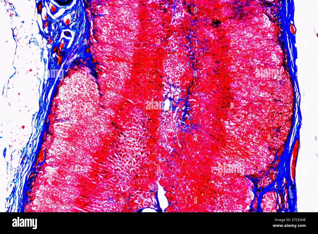 Human adrenal or suprarenal gland showing fibrous capsule, zona glomerulosa, fasciculata, reticularis and medulla. Produces adrenaline, aldosterone, a Stock Photo