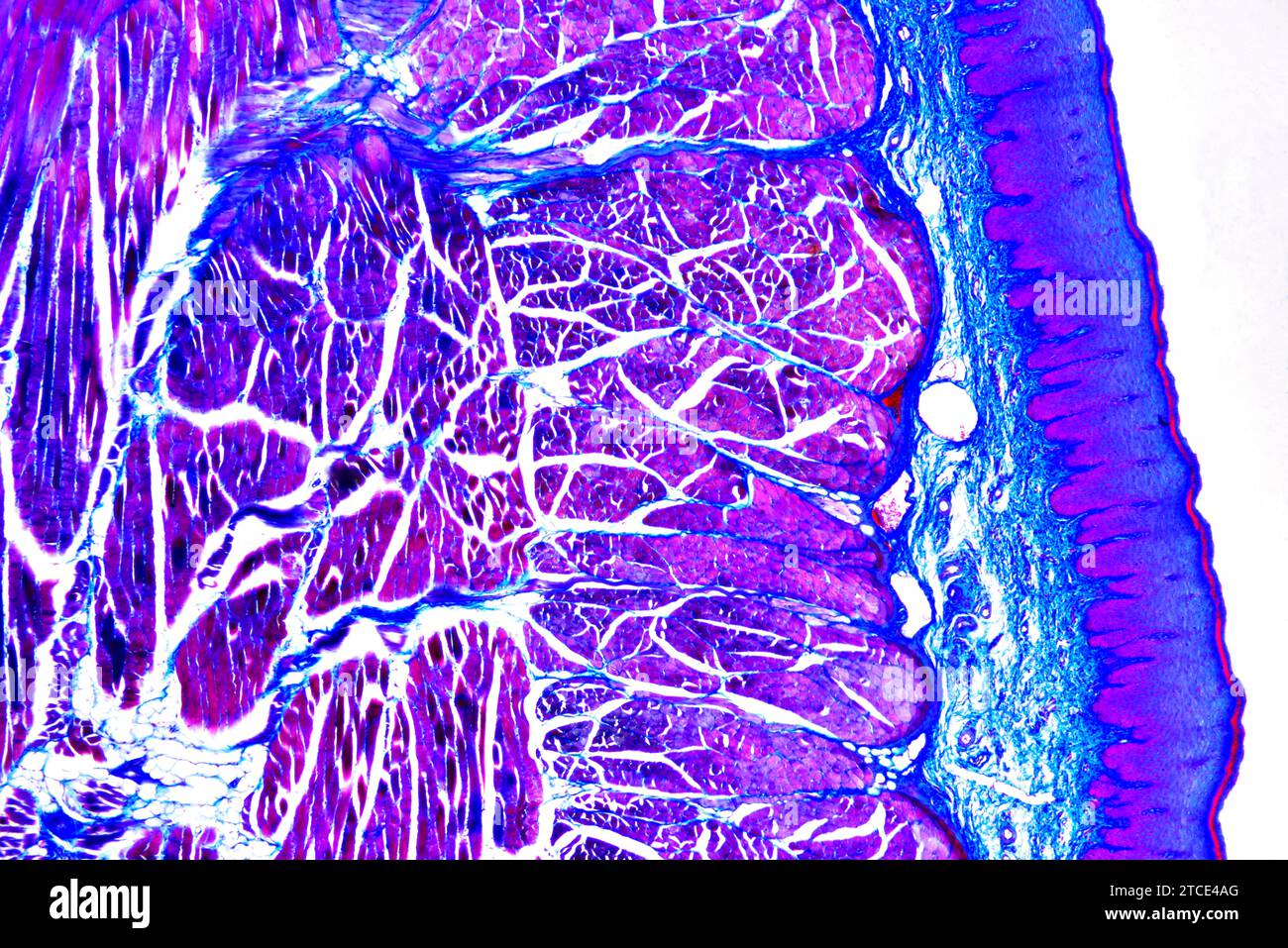 Tongue section showing lingual papillae, taste buds, striated muscles ...