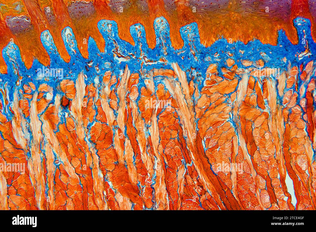 Tongue section showing lingual papillae, taste buds, striated muscles ...