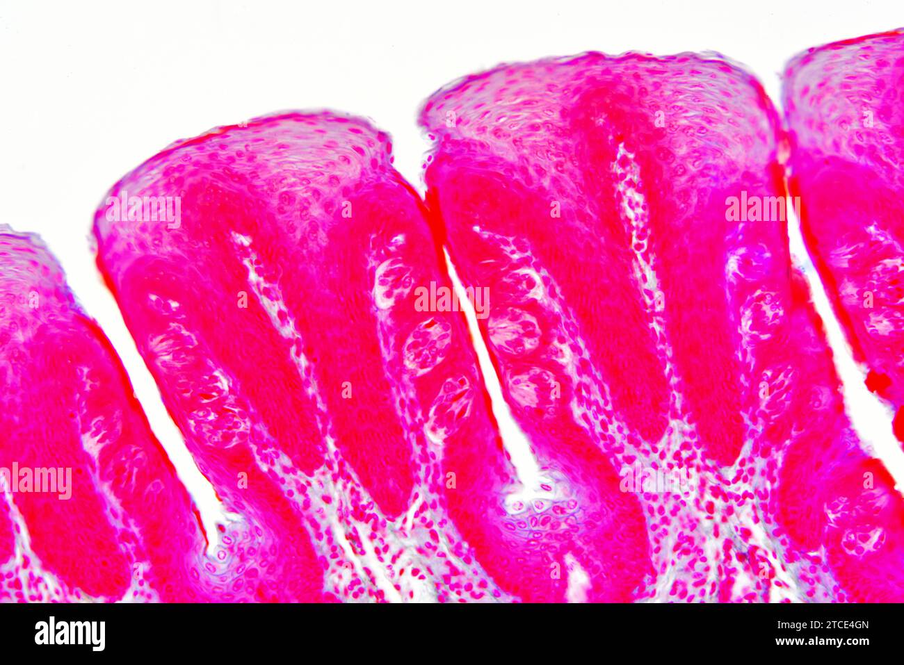 Tongue section showing taste buds and epithelium. Optical microscope ...