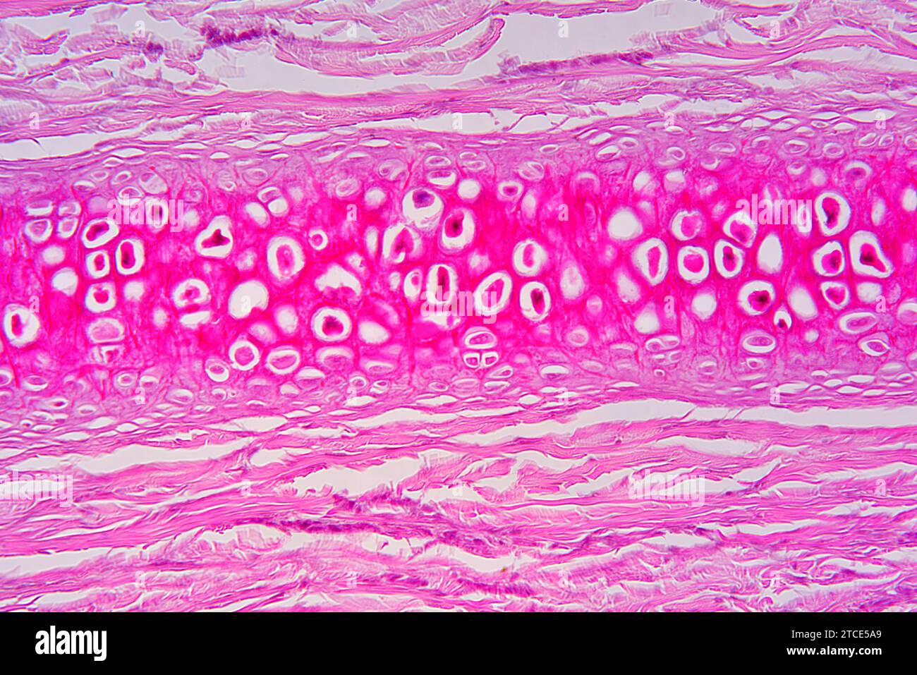 Elastic cartilaginous tissue from the ear showing chondrocytes, elastin ...