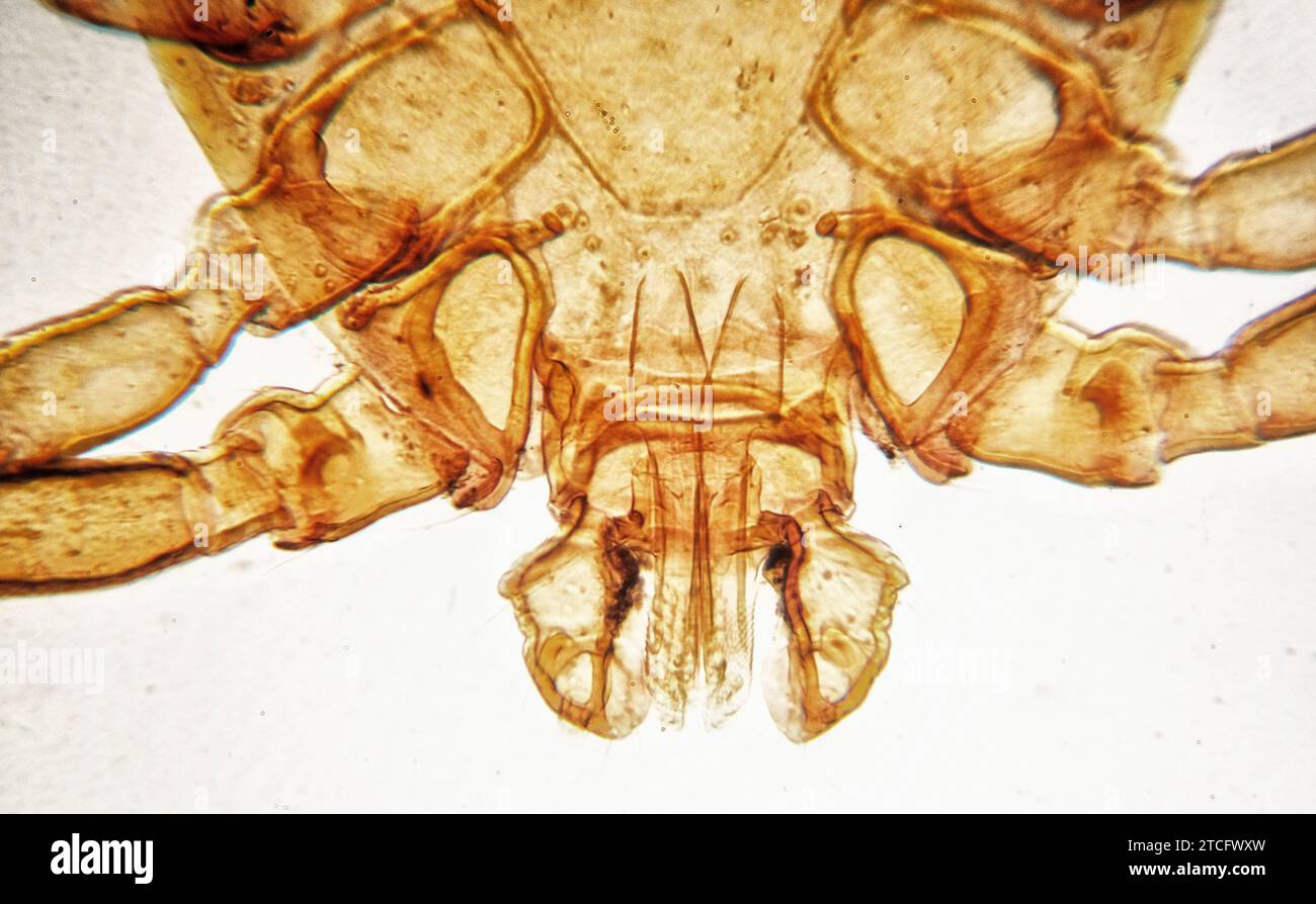 A microscope view at 100x showing the head of a dog tick Stock Photo