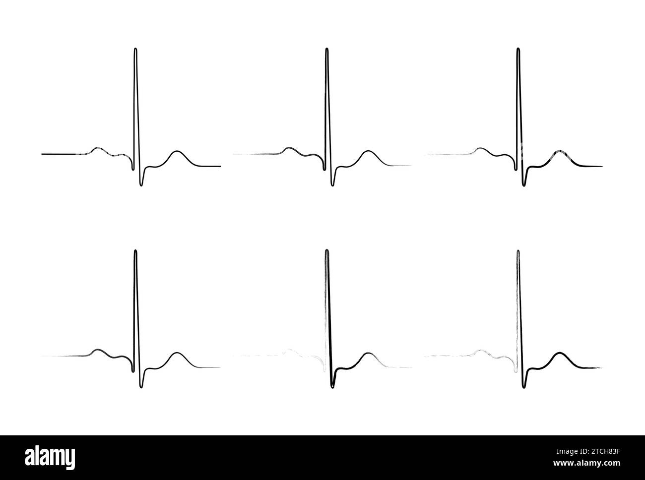 Ventricular repolarization, Cardiac cycle, ECG of heart in normal sinus rhythm, QT interval of ECG. Stock Vector