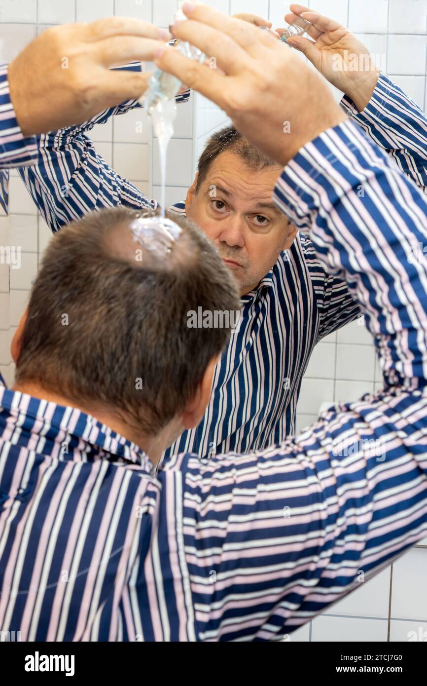 A man in pajamas applies a preparation for baldness in the bathroom in front of the mirror Stock Photo