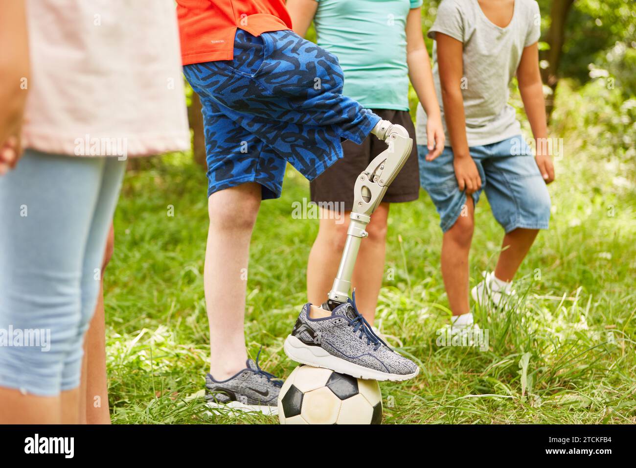Group of children playing with soccer ball with boy with prosthetic leg in summer Stock Photo