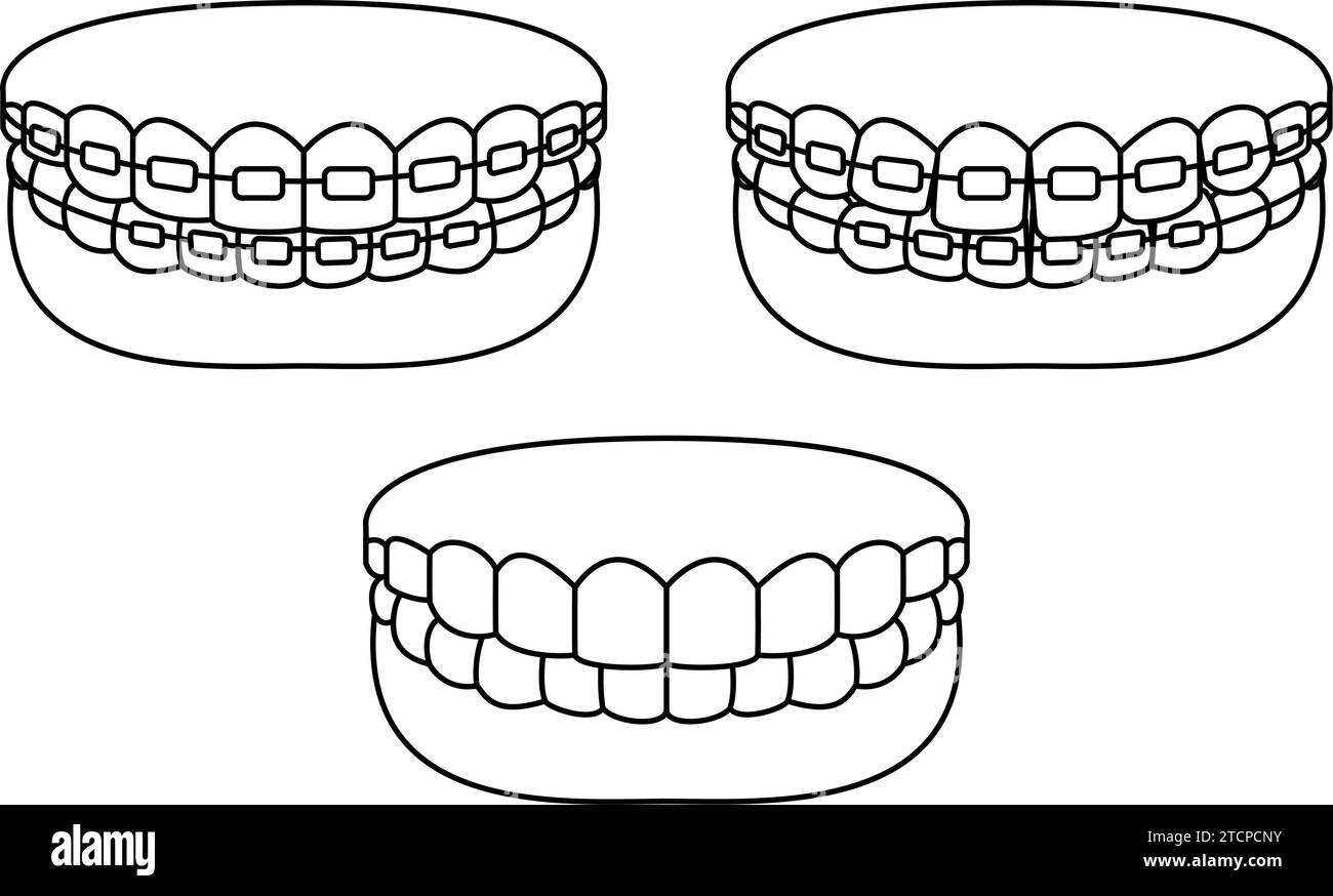 Teeth with metal brackets in cosmetic dentistry and orthodontics, simple line drawing, Vector Illustration Stock Vector