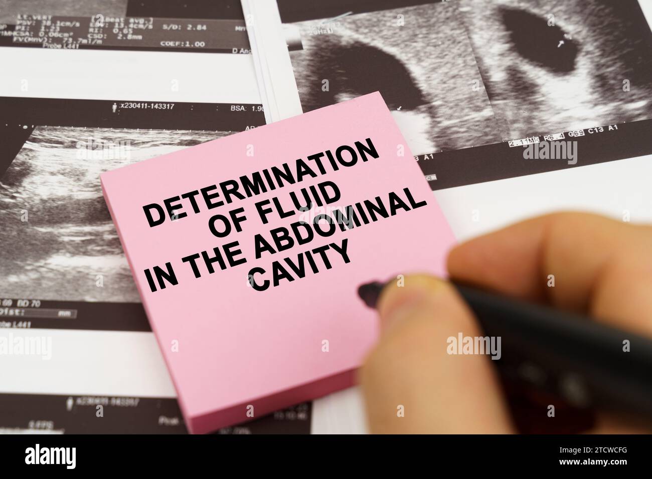 Medical concept. On the ultrasound pictures there are stickers that say