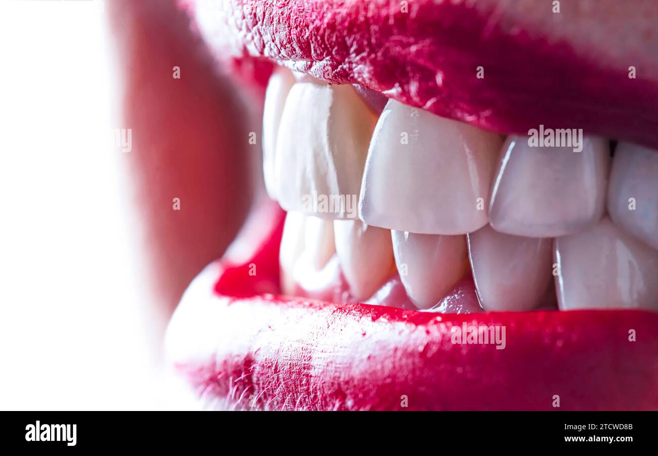 Emax crowns and veneers like natural color Stock Photo Alamy