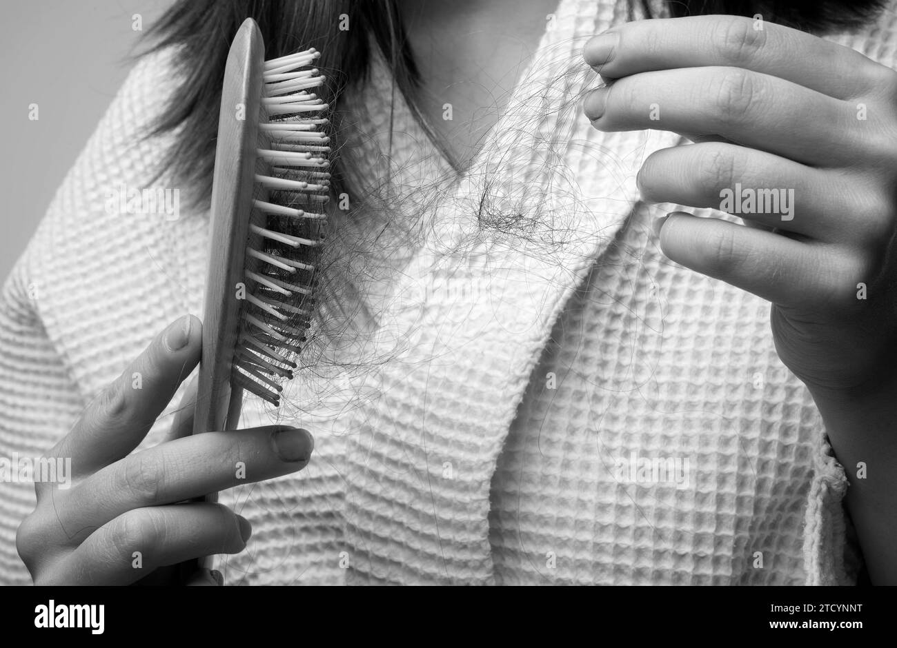 Hair loss in women. Young woman is upset because of hair loss. Problem