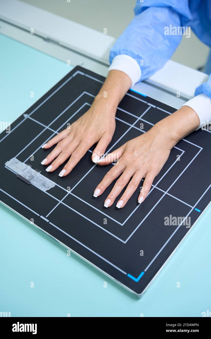 Finger Ray Hand x ray palmar hi-res stock photography and images - Alamy