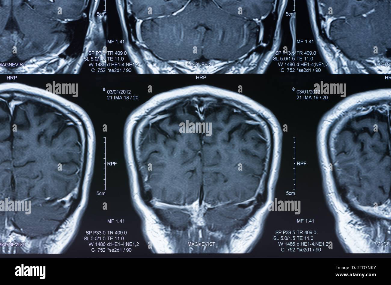 magnetic resonance image, mri scan of the brain Stock Photo - Alamy