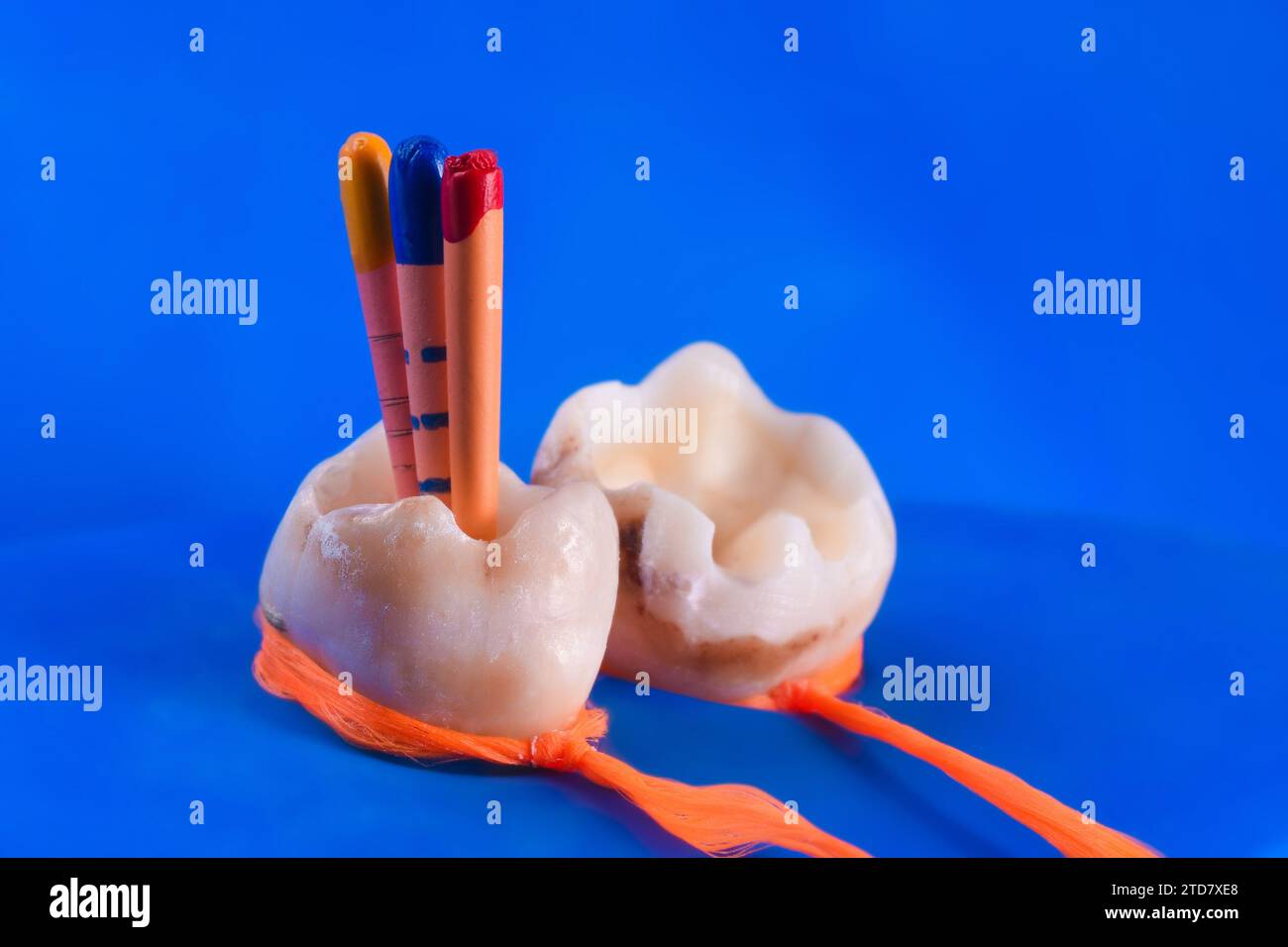 tooth rootcanal treatment Stock Photo